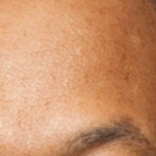 CodeFormer forehead detail