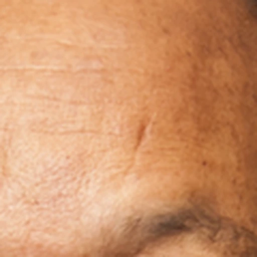 Ground-truth forehead detail