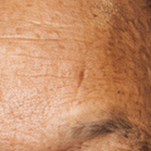IConFace forehead detail